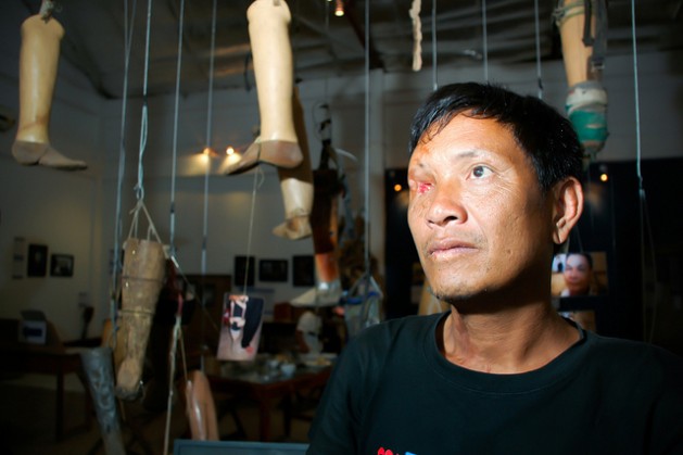 Ta Doangchom, víctima de una bomba de racimo, al lado de las prótesis caseras del Centro Nacional de Rehabilitación – Empresa Cooperativa de Ortopedia y Prótesis, en Vientiane, Laos. Crédito: Irwin Loy/IPS