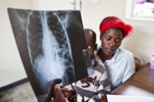 La tuberculosis permanece como la enfermedad infecciosa más letal en el mundo y en 2015 mató más de 1,8 millones de personas. Crédito: MSF